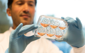 A scientist wearing gloves A scientist wearing gloves holds a clear multiwell cell culture plate with wells containing orange-labeled samples.