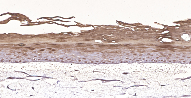 Millicell Skin Basal Layer Organotypic skin models contain actively proliferating keratinocytes. (C)