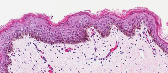 Neonatal Skin Tissue-b <b>B</b>. Neonatal Skin Tissue