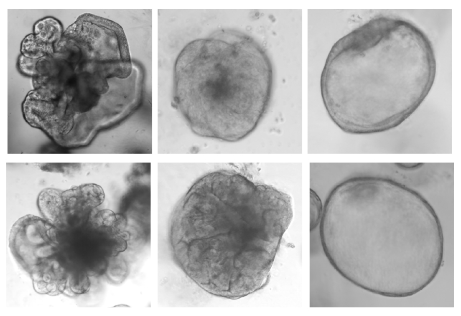 ScLPO morphology Microscopy images of the diversity in ScLPO morphology, from smooth circles to blob-like features.