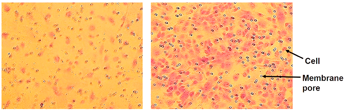In vitro VEGF stimulated cell migration of endothelial cells