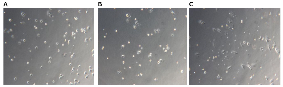 Microscopy image of Kupffer cells at 6, 24, and 48 hours. Light grey square with small dark grey dots that indicate cells. Microscopy image of Kupffer cells at 6, 24, and 48 hours. Light grey square with small dark grey dots that indicate cells.