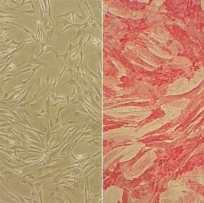Human Pulmonary Artery Smooth Muscle Cells (HPASMC) Culture Protocol Human Pulmonary Artery Smooth Muscle Cells (HPASMC)