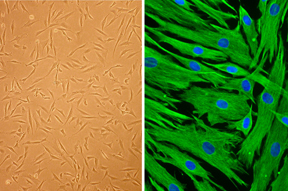Human Follicle Dermal Papilla Cells (HFDPC) Human Follicle Dermal Papilla Cells (HFDPC)