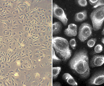 Human Bronchial Epithelial Cells (HBEpC) Human Bronchial Epithelial Cells (HBEpC)