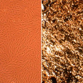 Human Osteoblasts Human Osteoblasts