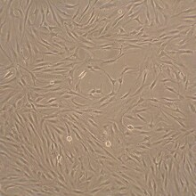 Human Fibroblast-Like Synoviocytes (HFLS) Human Fibroblast-Like Synoviocytes (HFLS)