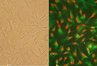 Human Cardiac Fibroblasts Human Cardiac Fibroblasts