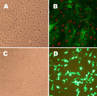 Human pulmonary artery endothelial cells Human Pulmonary Artery Endothelial Cells (HPAEC)