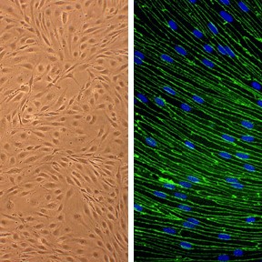 Rat Brain Microvascular Endothelial Cells (RBMVEC) Rat Brain Microvascular Endothelial Cells (RBMVEC)