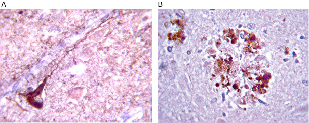 amyloid-antibody Anti-β-Amyloid antibody staining