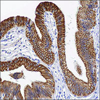 Light microscopy image of anti-PIR antibody validation by IHC on FFPE human bladder sections using diaminobenzidine (DAB) enzymatic detection (brown chromogen) and counterstaining with hematoxylin (blue). Light microscopy image of anti-PIR antibody validation by IHC on FFPE human bladder sections using diaminobenzidine (DAB) enzymatic detection (brown chromogen) and counterstaining with hematoxylin (blue).