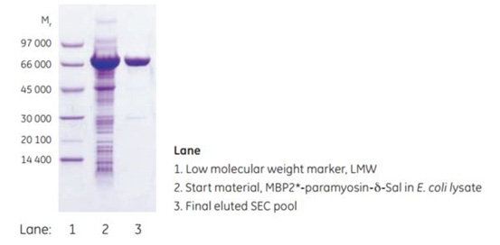 SDS-PAGE analysis SDS-PAGE analysis