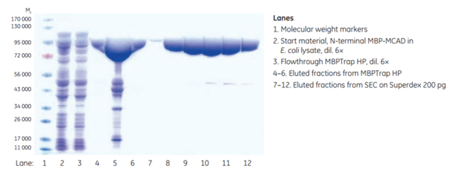 SDS-PAGE analysis SDS-PAGE analysis