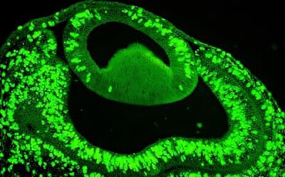 Proliferating cells in the eye of E4 chick embryo using BrdU staining