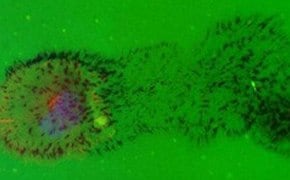 Fluorescence microscopy image displaying a cell-based assay with green fluorescent protein expression, indicative of active cellular processes, alongside concentrated spots of red and yellow fluorescence highlighting specific markers or areas of interest within the cells.