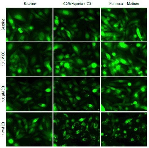 Live cell imaging in hypoxia-induced autophagy assay using the CellASIC® system