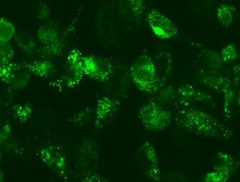 Fluorescent lentiviral particle cellular assay assesses autophagy