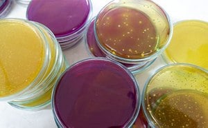 Microbial cell culture