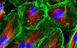 Fluorescence microscopy image showcasing primary cell culture with cells stained to highlight various components: nuclei in blue, actin filaments in green, and mitochondria in red.
