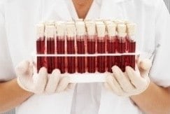 Blood samples in test tubes