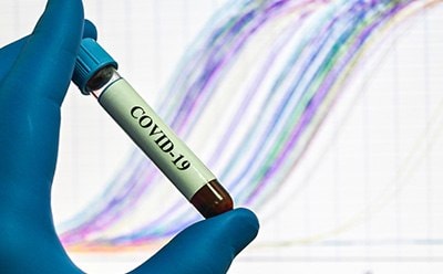 SARS-CoV-2 blood sample in test tube