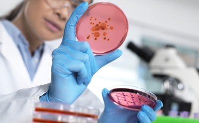 Female scientist examining microbiological culture in petri dish.