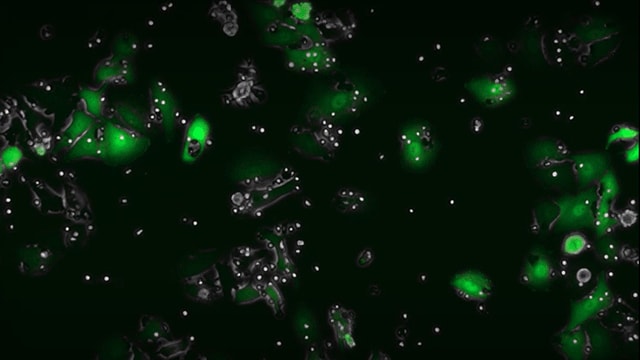 NK killing with anti-EGFR NK killing with anti-EGFR visualized by live cell imaging using the CellASIC® ONIX2 system