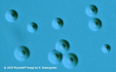 Mycoplasma pneumoniae FH Colonies 10 CFU