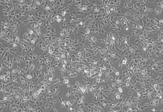 HT1080 fibrosarcoma cells Brightfield image of HT1080 fibrosarcoma cells cultured in PromoCell® Cancer Cell Line Medium XF
