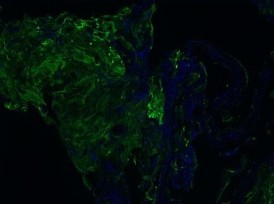 Purified Antibodies Purified antibodies improve the accuracy of spatial biology research by delivering dependable data on cellular interactions within tissues.