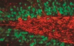 Primary antibodies slide