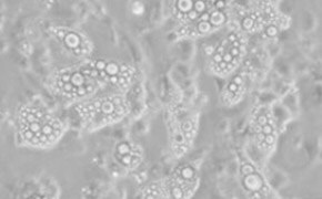 3T3-L1 Differentiation Kit Cells are filled with circles of various sizes indicating lipid droplets. The visible lipid droplets and cells span the foreground of the image.