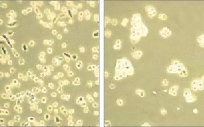 Cell dissociation This image presents a comparative microscopic analysis of cellular structures, showcasing two distinct photomicrographs. On the left, a dense aggregation of cells or microorganisms is observed, indicative of a possibly active growth environment. The right photomicrograph reveals a sparser distribution, potentially reflecting the impact of varying experimental conditions on cellular behavior or population density.
