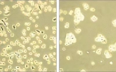 Brightfield microscopy of the progress of cell detachment with dissociation reagents