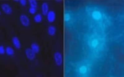 DNA detection agents such as DAPI or Hoechst reveal the presence of mycoplasma in contaminated cell cultures (right) Common DNA detection agents such as DAPI or Hoechst reveal the presence of mycoplasma in contaminated cultures using fluorescent microscopy.