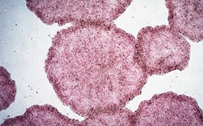 H9人类胚胎干细胞用碱性磷酸酶（AP）染色。