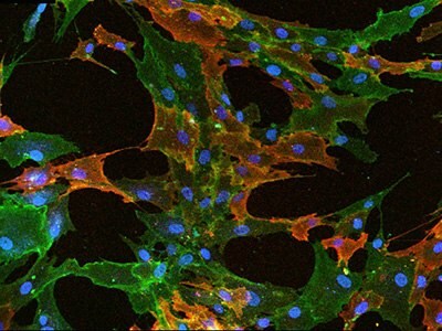 Mesenchymal stem cells fluorescently stained for immunocytochemistry