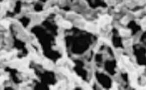 Electron micrograph of a cellulose nitrate membrane filter Electron micrograph of a cellulose nitrate membrane filter
