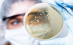 Bacterial contaminants on plate of agar growth media