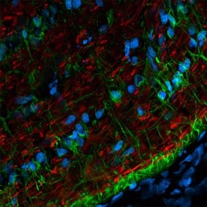 大鼠视神经冰冻切片用小鼠抗神经丝H抗体和CF568山羊抗小鼠抗体（神经元突起，红色），以及高度交叉吸附的兔抗GFAP抗体和CF488A山羊抗兔抗体（神经胶质细胞，绿色）进行染色。细胞核用 RedDot2 （青色）染色。