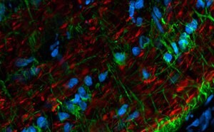 Frozen section of Rat optic nerve stained with Mouse Anti-neurofilament H and CF568 Goat Anti-Mouse (neuronal processes, red), Rabbit Anti-GFAP and CF488A Goat Anti-Rabbit, highly cross-adsorbed (glial cells, green). Nuclei are stained with RedDot2 (cyan).