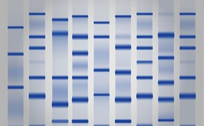 Protein gel stained with Coomassie blue stain