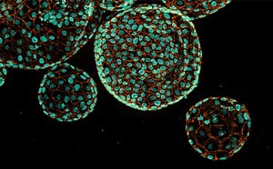 PDAC Organoids Microscopy image of pancreatic ductal adenocarcinoma organoids