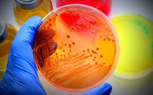 Petri dish of bacterial contaminants from water Petri dish with visible bacterial growth