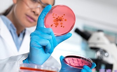 微生物学质检过滤器、过滤和检测系统及耗材