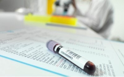 A close-up of a blood sample tube resting on a laboratory report, with a researcher in the background examining samples under a microscope.