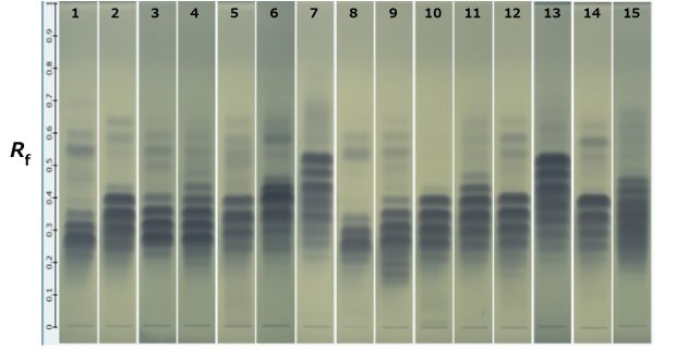 HPTLC bands of blue color in varying intensities obtained for 15 different oils on a Silica Gel 60 RP18 F254 plates kept next to each other, labeled 1 to 15 from left to right.
