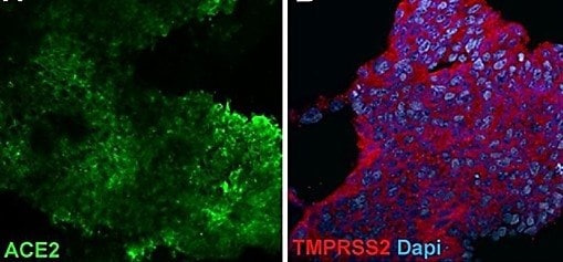 Microscopy images of lung organoids stained with antibodies