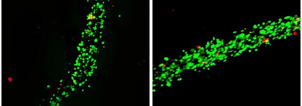 Bioprinting of human mesenchymal stem cells using PhotoCol